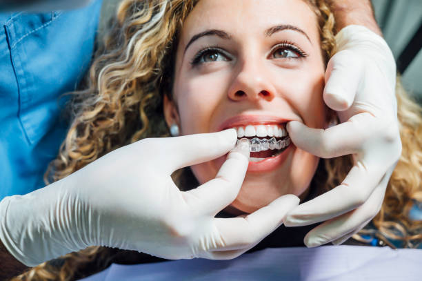Why Retention Matters After Invisalign Even When Your Teeth Look Perfect – Telegraph