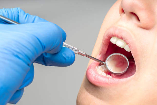Why Can Gum Disease Return After Treatment? Habits That Matter Long-Term – Telegraph