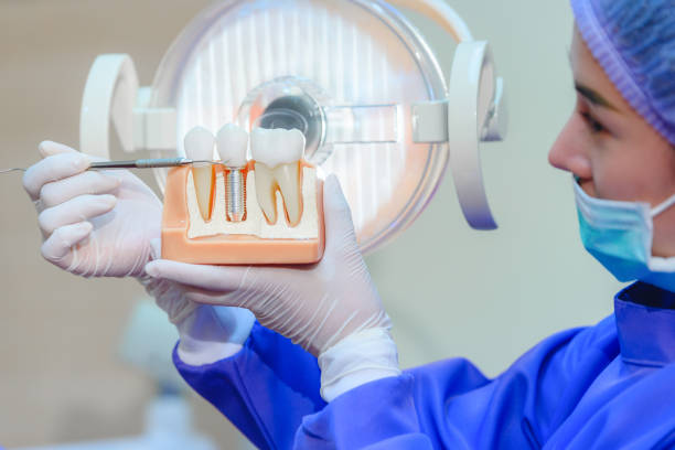 What Can Make One Dental Implant Case More Complex Than Another? – Telegraph